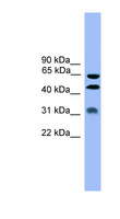 SERPINA4 / Kallistatin Antibody - SERPINA4 / Kallistatin antibody Western blot of MCF7 cell lysate. This image was taken for the unconjugated form of this product. Other forms have not been tested.