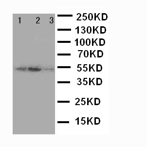 SERPINA4 / Kallistatin Antibody - WB of SERPINA4 / Kallistatin antibody. Lane 1: SMMC Cell Lysate. Lane 2: COLO320 Cell Lysate. Lane 3: JURKAT Cell Lysate..