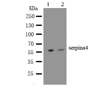 SERPINA4 / Kallistatin Antibody - WB of SERPINA4 / Kallistatin antibody. Lane 1: HELA Cell Lysate. Lane 2: SKOV Cell Lysate.