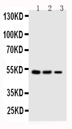 SERPINA4 / Kallistatin Antibody - Anti-Kallistatin antibody, Western blotting Lane 1: SMMC Cell LysateLane 2: COLO320 Cell LysateLane 3: JURKAT Cell Lysate
