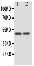 SERPINA4 / Kallistatin Antibody - Anti-Kallistatin antibody, Western blotting Lane 1: HELA Cell LysateLane 2: SKOV Cell Lysate