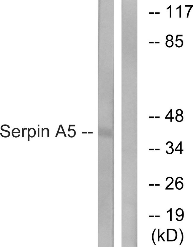 SERPINA5 / PCI Antibody - Western blot analysis of lysates from Jurkat cells, using Serpin A5 Antibody. The lane on the right is blocked with the synthesized peptide.