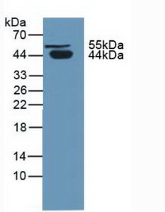 SERPINA5 / PCI Antibody - Western Blot; Sample: Human Urine.