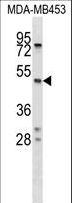 SERPINA5 / PCI Antibody - SERPINA5 Antibody western blot of MDA-MB453 cell line lysates (35 ug/lane). The SERPINA5 antibody detected the SERPINA5 protein (arrow).