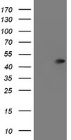 SERPINA5 / PCI Antibody - HEK293T cells were transfected with the pCMV6-ENTRY control (Left lane) or pCMV6-ENTRY SERPINA5 (Right lane) cDNA for 48 hrs and lysed. Equivalent amounts of cell lysates (5 ug per lane) were separated by SDS-PAGE and immunoblotted with anti-SERPINA5.