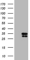 SERPINA5 / PCI Antibody - HEK293T cells were transfected with the pCMV6-ENTRY control (Left lane) or pCMV6-ENTRY SERPINA5 (Right lane) cDNA for 48 hrs and lysed. Equivalent amounts of cell lysates (5 ug per lane) were separated by SDS-PAGE and immunoblotted with anti-SERPINA5.