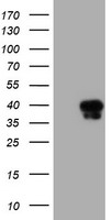 SERPINA5 / PCI Antibody - HEK293T cells were transfected with the pCMV6-ENTRY control (Left lane) or pCMV6-ENTRY SERPINA5 (Right lane) cDNA for 48 hrs and lysed. Equivalent amounts of cell lysates (5 ug per lane) were separated by SDS-PAGE and immunoblotted with anti-SERPINA5.