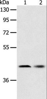 SERPINA5 / PCI Antibody - Western blot analysis of Human fetal liver tissue and HeLa cell, using SERPINA5 Polyclonal Antibody at dilution of 1:700.