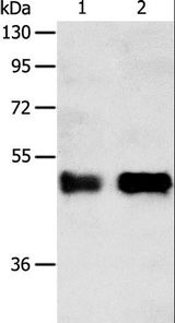 SERPINA5 / PCI Antibody - Western blot analysis of Human liver cancer tissue and A549 cell, using SERPINA5 Polyclonal Antibody at dilution of 1:750.