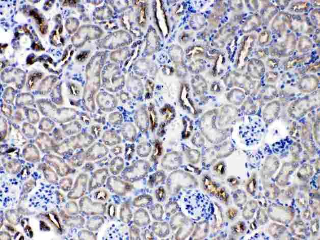 SERPINA5 / PCI Antibody - SERPINA5 was detected in paraffin-embedded sections of mouse kidney tissues using rabbit anti- SERPINA5 Antigen Affinity purified polyclonal antibody