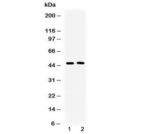 SERPINA5 / PCI Antibody - Western blot testing of 1) rat liver and 2) human SKOV3 lysate with SERPINA5 antibody at 0.5ug/ml. Predicted molecular weight: 46-52 kDa.