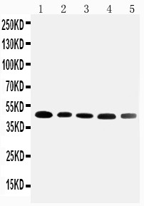 SERPINA6 / CBG Antibody - WB of SERPINA6 / CBG antibody. Lane 1: HELA Cell Lysate. Lane 2: A431 Cell Lysate. Lane 3: U87 Cell Lysate. Lane 4: 22RV1 Cell Lysate. Lane 5: PANC Cell Lysate.