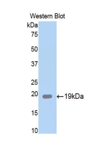 SERPINA6 / CBG Antibody - Western blot of recombinant SERPINA6 / CBG.  This image was taken for the unconjugated form of this product. Other forms have not been tested.