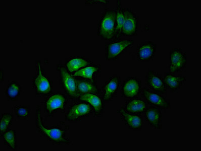 SERPINA6 / CBG Antibody - Immunofluorescent analysis of A549 cells using SERPINA6 Antibody at dilution of 1:100 and Alexa Fluor 488-congugated AffiniPure Goat Anti-Rabbit IgG(H+L)