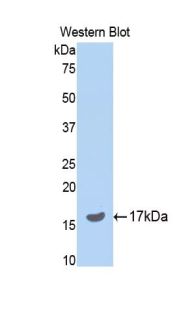 SERPINA6 / CBG Antibody - Western blot of recombinant SERPINA6 / CBG.  This image was taken for the unconjugated form of this product. Other forms have not been tested.