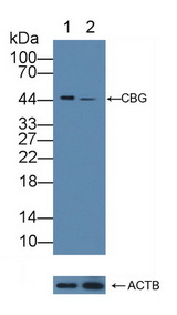 SERPINA6 / CBG Antibody - Knockout Varification: Lane 1: Wild-type A375 cell lysate; Lane 2: CBG knockout A375 cell lysate; Predicted MW: 45kd Observed MW: 45kd Primary Ab: 1µg/ml Rabbit Anti-Human CBG Antibody Second Ab: 0.2µg/mL HRP-Linked Caprine Anti-Rabbit IgG Polyclonal Antibody