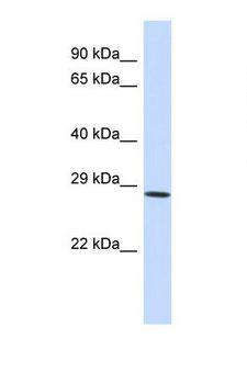 SERPINA6 / CBG Antibody - Western blot of Human HeLa. SERPINA6 antibody dilution 1.0 ug/ml.  This image was taken for the unconjugated form of this product. Other forms have not been tested.