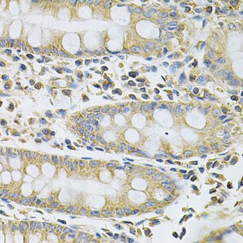 SERPINA6 / CBG Antibody - Immunohistochemistry of paraffin-embedded human colon using SERPINA6 Antibody at dilution of 1:100 (40x lens).