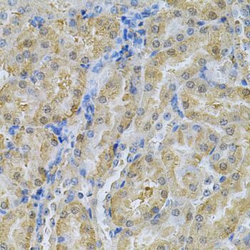SERPINA6 / CBG Antibody - Immunohistochemistry of paraffin-embedded mouse kidney using SERPINA6 Antibody at dilution of 1:100 (40x lens).