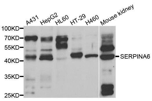 SERPINA6 / CBG Antibody - Western blot analysis of extracts of various cell lines, using SERPINA6 antibody at 1:1000 dilution. The secondary antibody used was an HRP Goat Anti-Rabbit IgG (H+L) at 1:10000 dilution. Lysates were loaded 25ug per lane and 3% nonfat dry milk in TBST was used for blocking. An ECL Kit was used for detection and the exposure time was 90s.