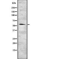 SERPINA6 / CBG Antibody - Western blot analysis SERPINA6 using COLO205 whole cells lysates