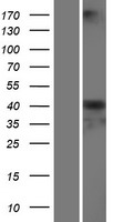 SERPINA6 / CBG Protein - Western validation with an anti-DDK antibody * L: Control HEK293 lysate R: Over-expression lysate