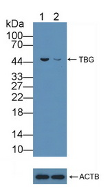 SERPINA7 / TBG Antibody - Knockout Varification: Lane 1: Wild-type Hela cell lysate; Lane 2: TBG knockout Hela cell lysate; Predicted MW: 46kd Observed MW: 46kd Primary Ab: 5µg/ml Rabbit Anti-Human TBG Antibody Second Ab: 0.2µg/mL HRP-Linked Caprine Anti-Rabbit IgG Polyclonal Antibody
