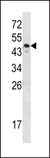 SERPINA7 / TBG Antibody - Western blot of SERPINA7 Antibody in MDA-MB231 cell line lysates (35 ug/lane). SERPINA7 (arrow) was detected using the purified antibody.