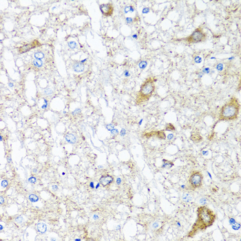 SERPINA7 / TBG Antibody - Immunohistochemistry of paraffin-embedded rat brain tissue.