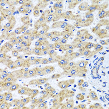 SERPINA7 / TBG Antibody - Immunohistochemistry of paraffin-embedded human liver tissue.