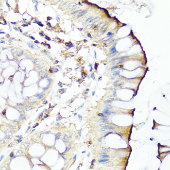 SERPINA7 / TBG Antibody - Immunohistochemistry of paraffin-embedded human colon tissue.