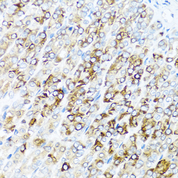 SERPINA7 / TBG Antibody - Immunohistochemistry of paraffin-embedded mouse stomach tissue.