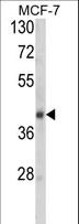 SERPINA9 Antibody - Western blot of SERPINA9 Antibody in MCF-7 cell line lysates (35 ug/lane). SERPINA9 (arrow) was detected using the purified antibody.