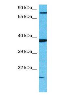 SERPINA9 Antibody - Western blot of SERPINA9 Antibody with human MCF7 Whole Cell lysate.  This image was taken for the unconjugated form of this product. Other forms have not been tested.