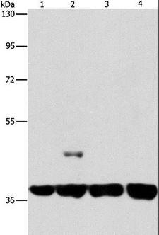 SERPINA9 Antibody - Western blot analysis of 293T and 231 cell, U937 and Raji cell, using SERPINA9 Polyclonal Antibody at dilution of 1:350.