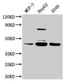 SERPINB1 Antibody - Western blot All lanes: SERPINB1 antibody at 2µg/ml Lane 1: HepG2 whole cell lysate Lane 2: Hela whole cell lysate Lane 3: A549 whole cell lysate Lane 4: 293T whole cell lysate Secondary Goat polyclonal to rabbit IgG at 1/10000 dilution Predicted band size: 43, 27 kDa Observed band size: 43 kDa