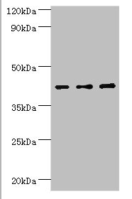 SERPINB1 Antibody - Western blot All lanes: Leukocyte elastase inhibitor antibody at 4µg/ml Lane 1: MCF-7 whole cell lysate Lane 2: Hela whole cell lysate Lane 3: HepG2 whole cell lysate Secondary Goat polyclonal to rabbit IgG at 1/10000 dilution Predicted band size: 43, 27 kDa Observed band size: 43 kDa