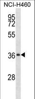 SERPINB1 Antibody - SERPINB1 Antibody western blot of NCI-H460 cell line lysates (35 ug/lane). The SERPINB1 antibody detected the SERPINB1 protein (arrow).