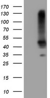 SERPINB1 Antibody - HEK293T cells were transfected with the pCMV6-ENTRY control (Left lane) or pCMV6-ENTRY SERPINB1 (Right lane) cDNA for 48 hrs and lysed. Equivalent amounts of cell lysates (5 ug per lane) were separated by SDS-PAGE and immunoblotted with anti-SERPINB1.