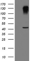 SERPINB1 Antibody - HEK293T cells were transfected with the pCMV6-ENTRY control (Left lane) or pCMV6-ENTRY SERPINB1 (Right lane) cDNA for 48 hrs and lysed. Equivalent amounts of cell lysates (5 ug per lane) were separated by SDS-PAGE and immunoblotted with anti-SERPINB1.