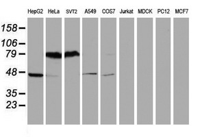 SERPINB1 Antibody - Western blot of extracts (35ug) from 9 different cell lines by using anti-SERPINB1 monoclonal antibody (HepG2: human; HeLa: human; SVT2: mouse; A549: human; COS7: monkey; Jurkat: human; MDCK: canine; PC12: rat; MCF7: human).