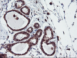 SERPINB1 Antibody - IHC of paraffin-embedded Human breast tissue using anti-SERPINB1 mouse monoclonal antibody. (Heat-induced epitope retrieval by 10mM citric buffer, pH6.0, 100C for 10min).