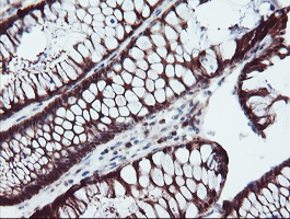 SERPINB1 Antibody - IHC of paraffin-embedded Human colon tissue using anti-SERPINB1 mouse monoclonal antibody. (Heat-induced epitope retrieval by 10mM citric buffer, pH6.0, 100C for 10min).