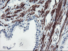 SERPINB1 Antibody - IHC of paraffin-embedded Human prostate tissue using anti-SERPINB1 mouse monoclonal antibody. (Heat-induced epitope retrieval by 10mM citric buffer, pH6.0, 100C for 10min).