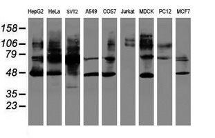 SERPINB1 Antibody - Western blot of extracts (35 ug) from 9 different cell lines by using g anti-SERPINB1 monoclonal antibody (HepG2: human; HeLa: human; SVT2: mouse; A549: human; COS7: monkey; Jurkat: human; MDCK: canine; PC12: rat; MCF7: human).