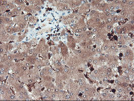 SERPINB1 Antibody - IHC of paraffin-embedded Human liver tissue using anti-SERPINB1 mouse monoclonal antibody.