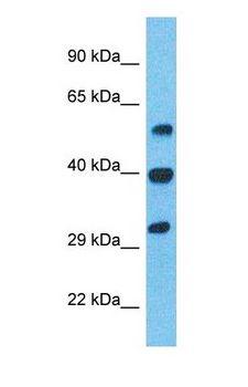 SERPINB1 Antibody - Western blot of ILEU Antibody with human Stomach Tumor lysate.  This image was taken for the unconjugated form of this product. Other forms have not been tested.