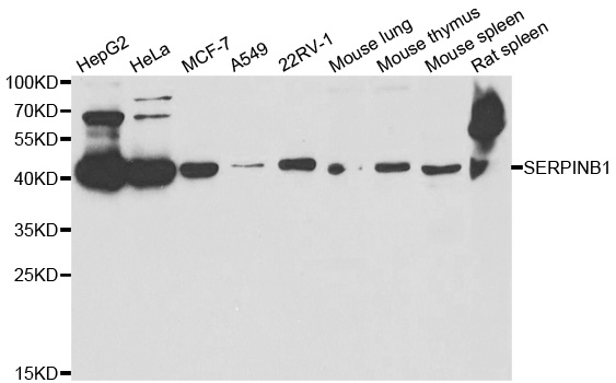 SERPINB1 Antibody - Western blot analysis of extracts of various cell lines.