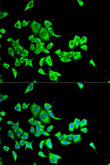 SERPINB1 Antibody - Immunofluorescence analysis of HeLa cells.