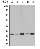 SERPINB1 Antibody - Western blot analysis of SerpinB1 expression in MCF7 (A); A549 (B); mouse lung (C); mouse spleen (D); rat spleen (E) whole cell lysates.